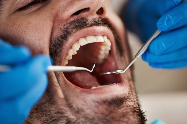 Best Emergency Dental Care for Trauma or Injury in Meyers, CA
