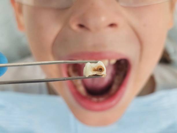 Best Emergency Dental Surgery in Meyers, CA